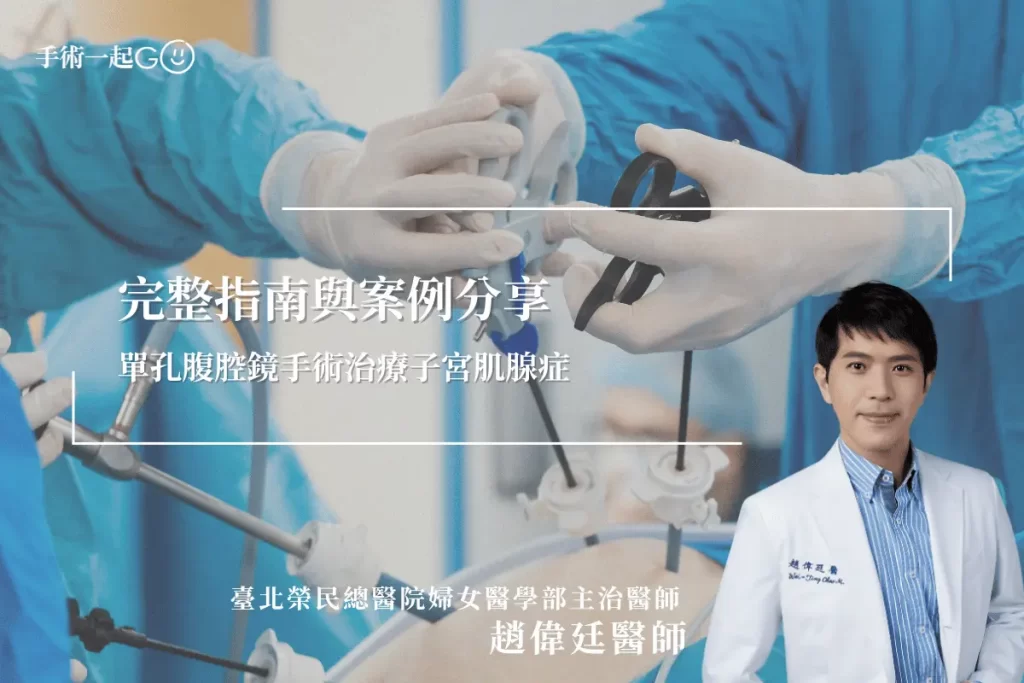 【趙偉廷醫師】單孔腹腔鏡手術治療子宮肌腺症：完整指南與案例分享