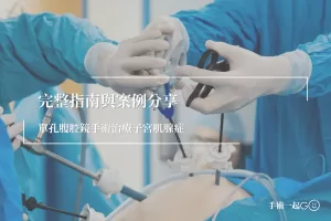 【趙偉廷醫師】單孔腹腔鏡手術治療子宮肌腺症：完整指南與案例分享