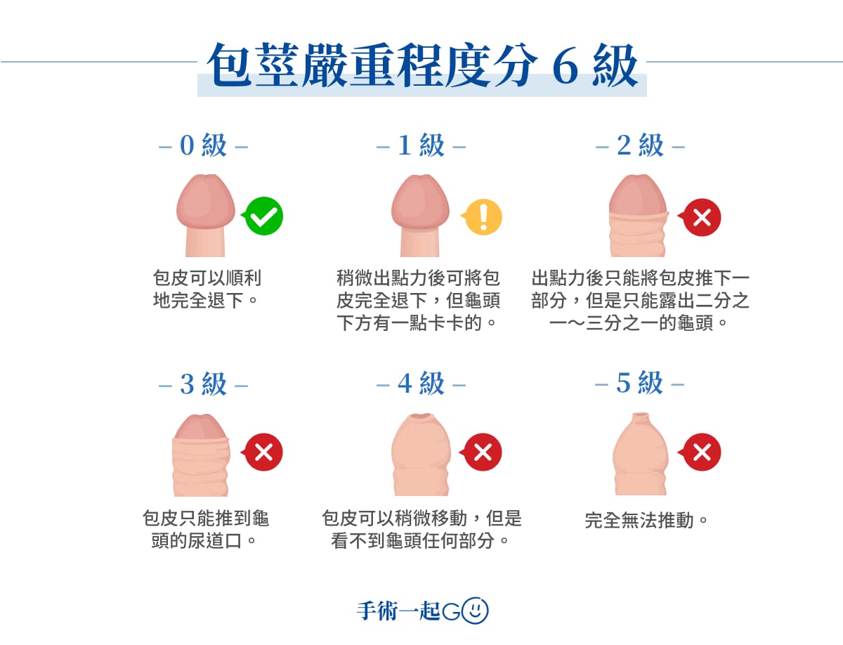 包莖嚴重程度分 6 級