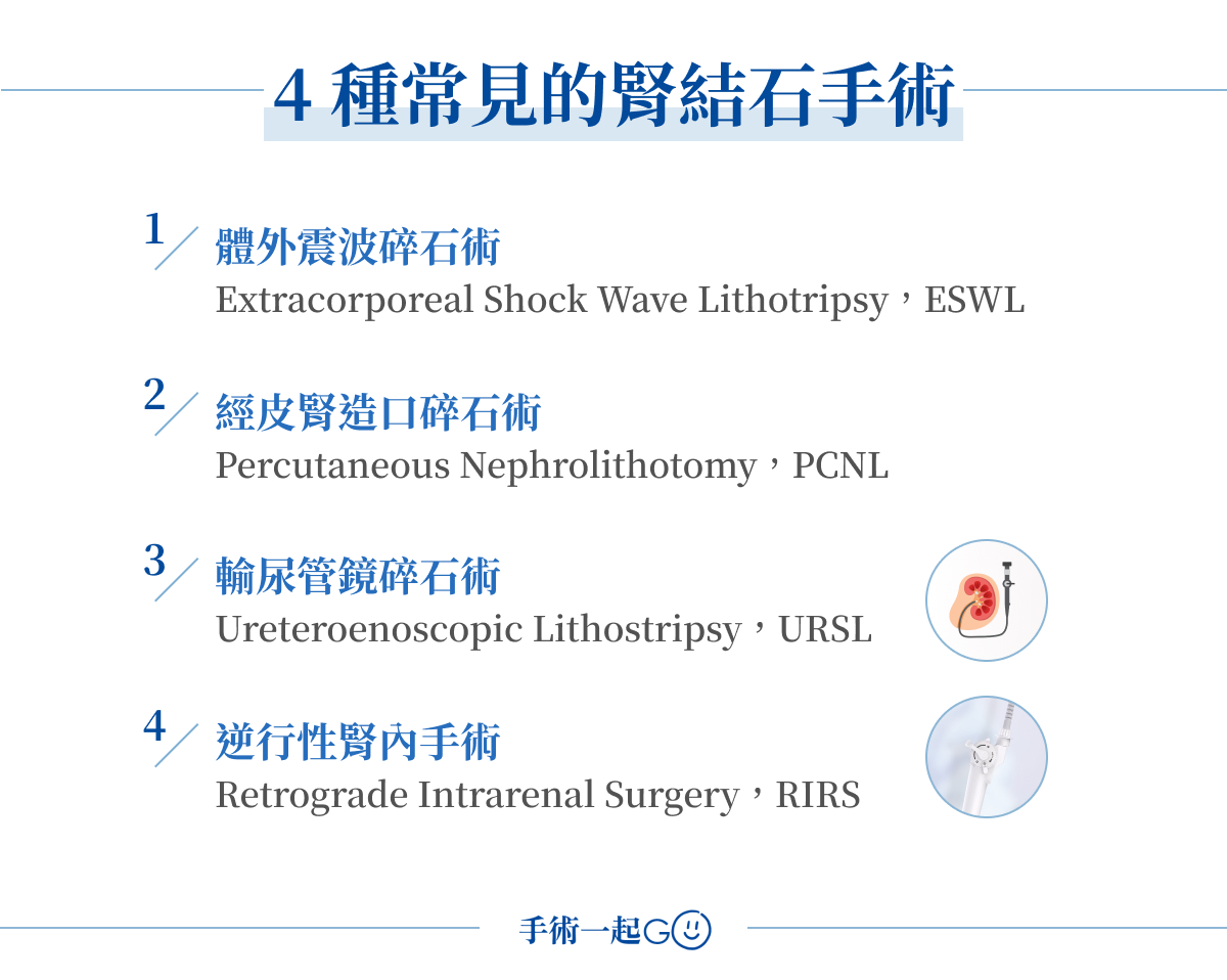 4 種常見的腎結石手術