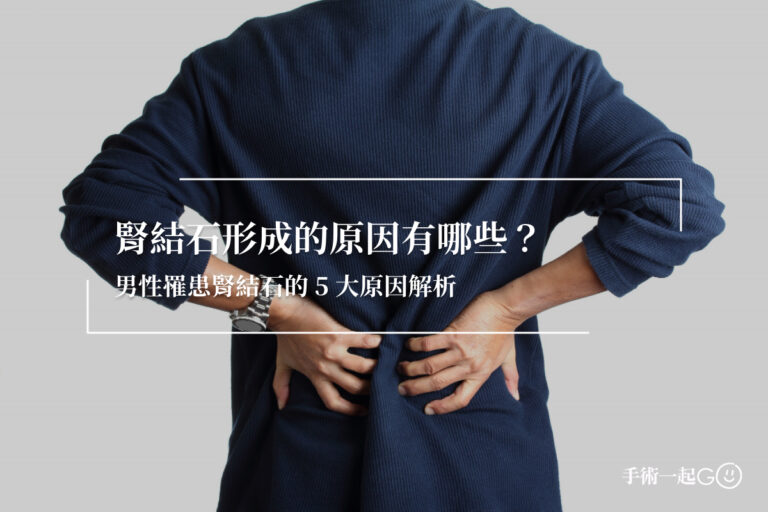 腎結石形成的原因有哪些？男性罹患腎結石的 5 大原因解析