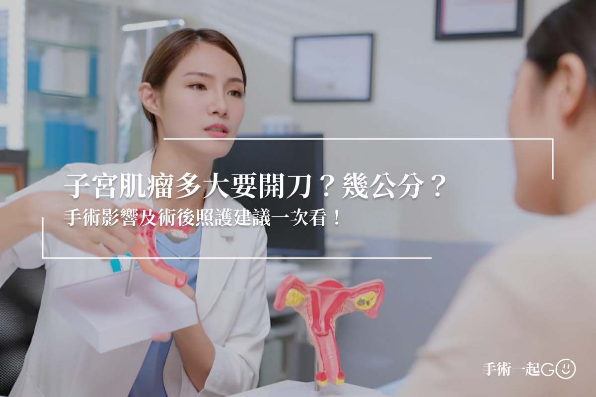 子宮肌瘤多大要開刀？幾公分？手術影響及術後照護建議一次看！