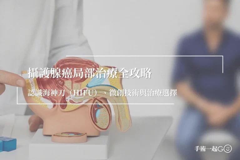 攝護腺癌局部治療全攻略：認識海神刀（HIFU）、微創技術與治療選擇